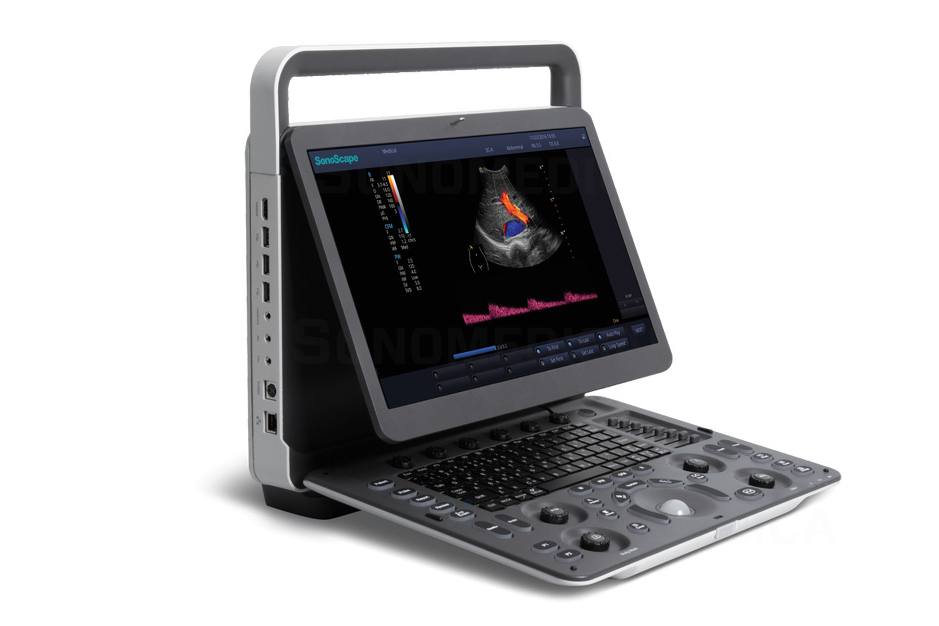 Przenośny ultrasonograf w opiece przedszpitalnej i ratownictwie